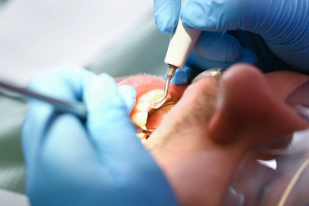 Best Emergency Denture Repair in Pine Lawn, MO